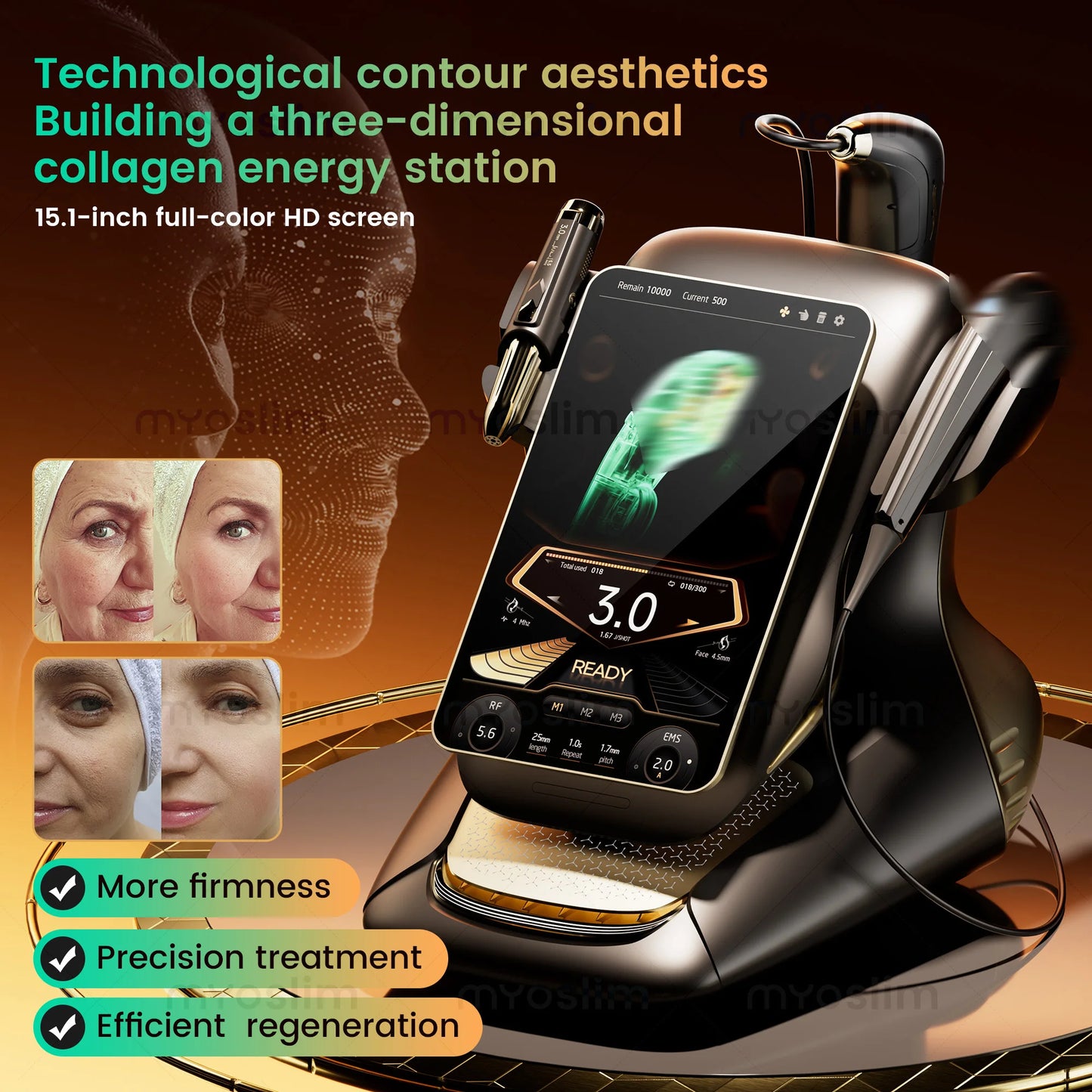 360MAX 25D HiFU Three In One Facial Machine Anti Aging